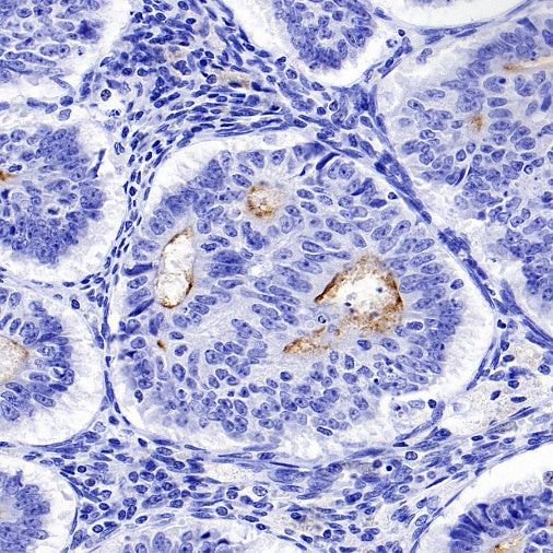 NaPi2b/SLC34A2 Recombinant Rabbit mAb (SDT-R229)