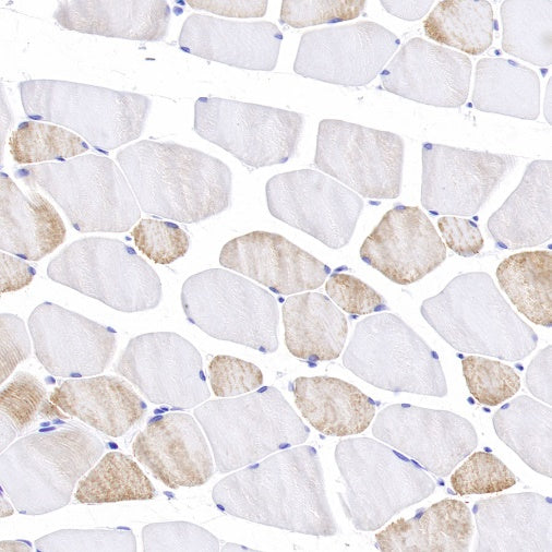 Sarcomeric Alpha Actinin Recombinant Rabbit mAb (S-1652-40)