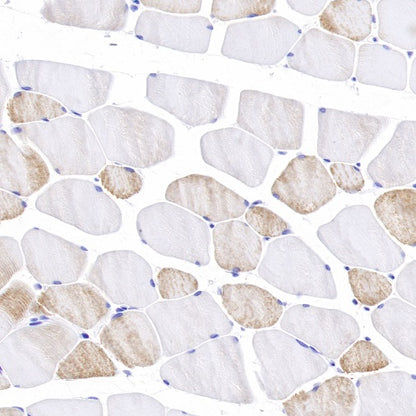 Sarcomeric Alpha Actinin Recombinant Rabbit mAb (S-1652-40)