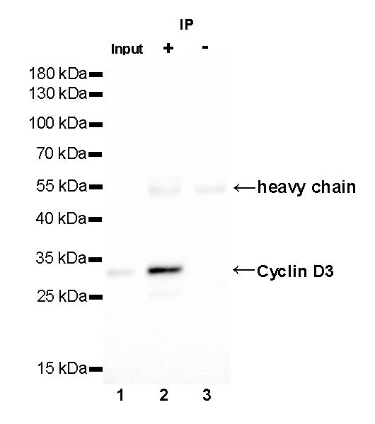 Cyclin D3 Recombinant Rabbit mAb (SDT-R124)
