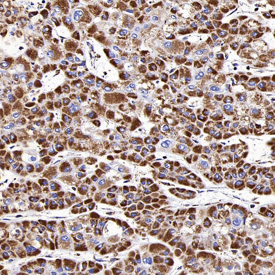 MTCO2 Recombinant Rabbit mAb (S-1891-72)