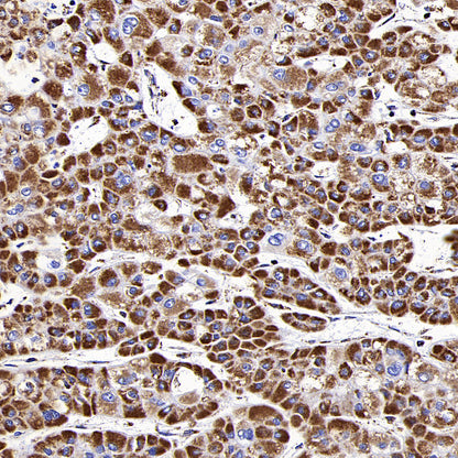 MTCO2 Recombinant Rabbit mAb (S-1891-72)
