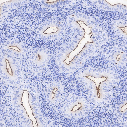 NaPi2b/SLC34A2 Recombinant Rabbit mAb (SDT-1771-79)