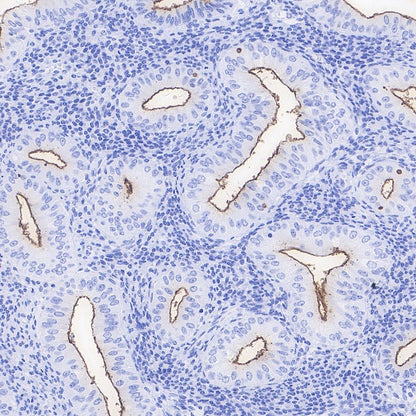 NaPi2b/SLC34A2 Recombinant Rabbit mAb (SDT-1771-79)