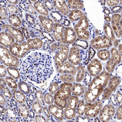 Catalase Recombinant Rabbit mAb (S-1925-3)