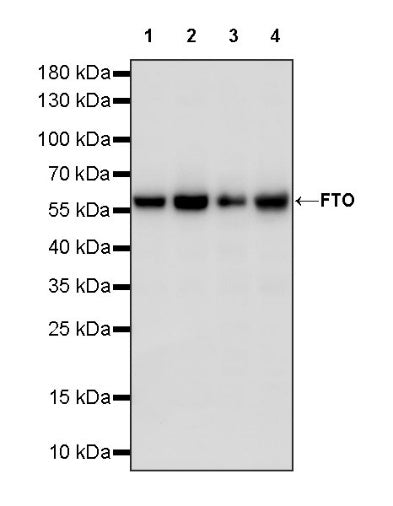 FTO Recombinant Rabbit mAb (S-1663-48)