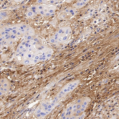 Versican Recombinant Rabbit mAb (S-3770-43)