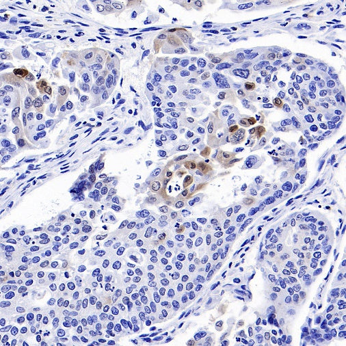 p27 Kip1 Recombinant Rabbit mAb (SDT-361-324)