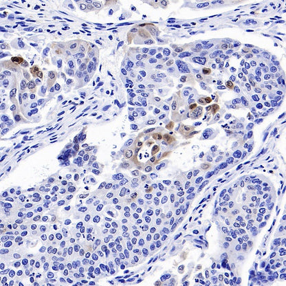 p27 Kip1 Recombinant Rabbit mAb (SDT-361-324)