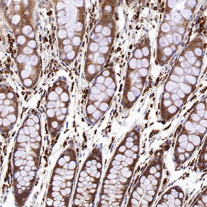 eEF2 Recombinant Rabbit mAb (S-1976-35)