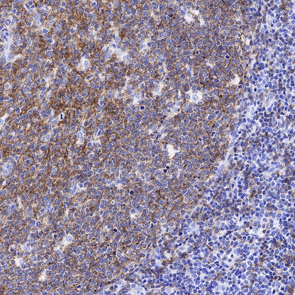 CD19 Recombinant Rabbit mAb (SDT-164-41)