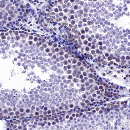 CDK9 Recombinant Rabbit mAb (S-2661-10)