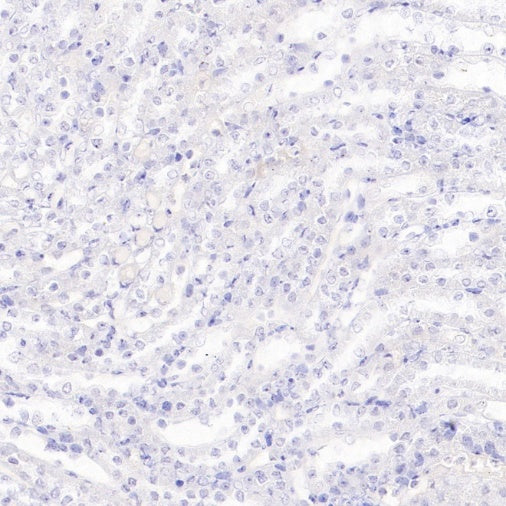 DAZL Recombinant Rabbit mAb (S-3113-35)