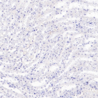 DAZL Recombinant Rabbit mAb (S-3113-35)