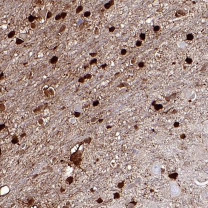 FABP7 Recombinant Rabbit mAb (S-762-41)