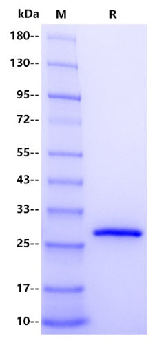 Human NNMT Protein, His Tag