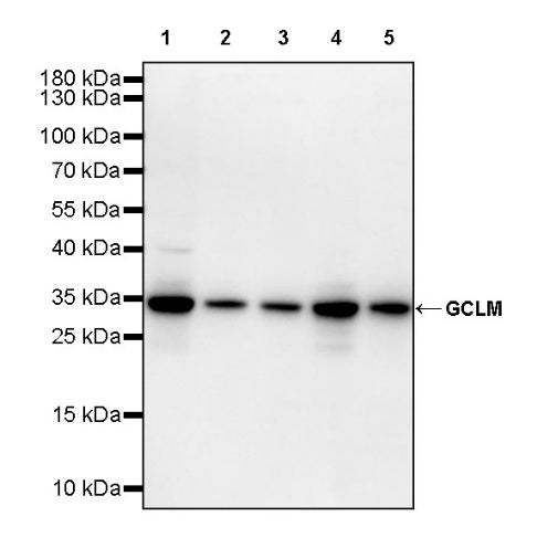 GCLM Recombinant Rabbit mAb (S-2209-19)