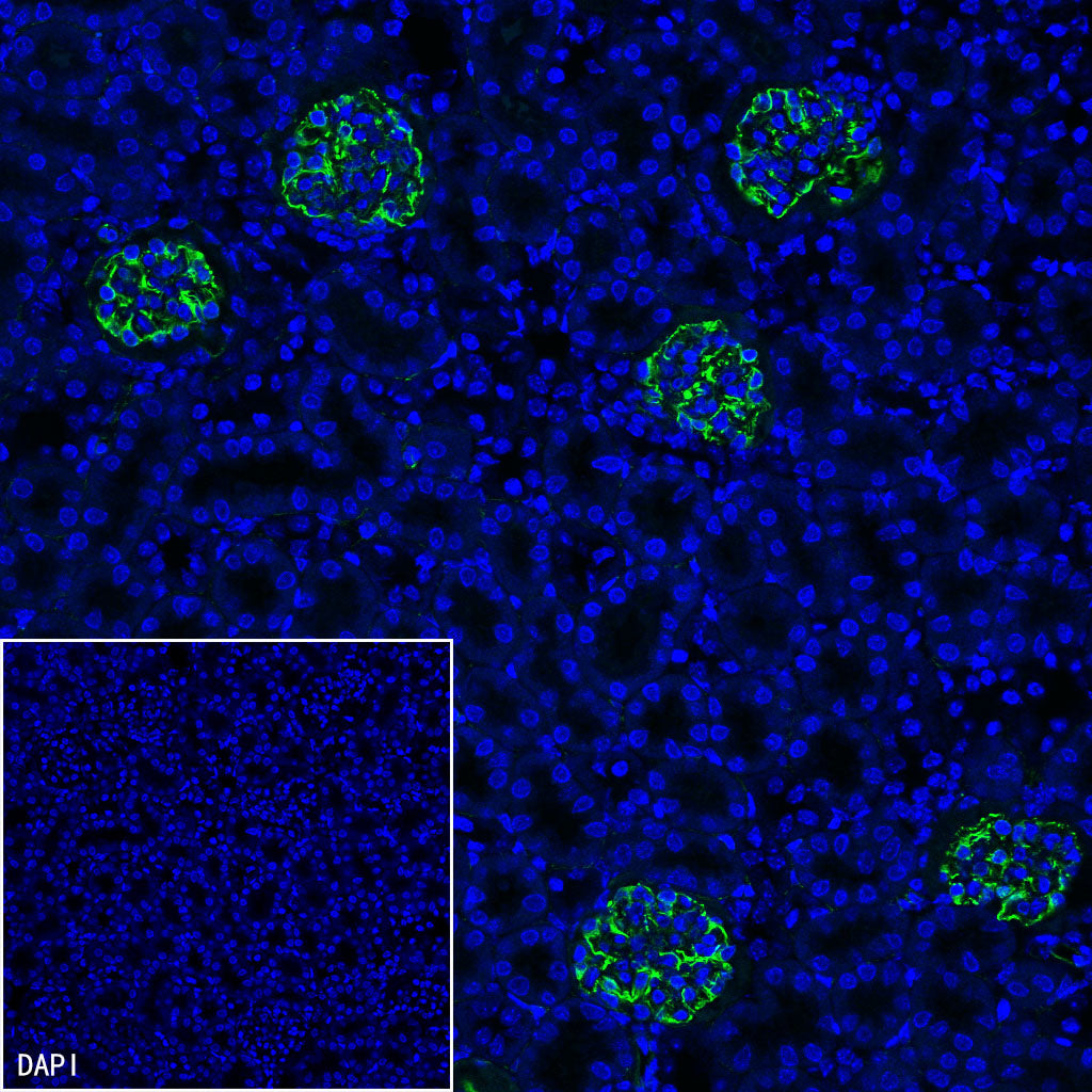 Nestin Recombinant Rabbit mAb (S-3890-112)