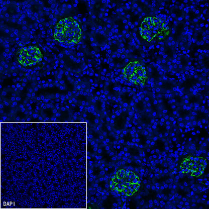 Nestin Recombinant Rabbit mAb (S-3890-112)