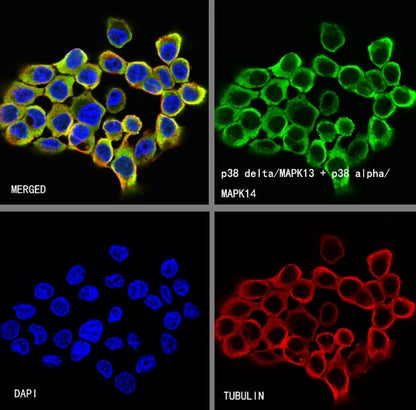 p38 delta/MAPK13 + p38 alpha/MAPK14 Recombinant Mouse mAb (S-3860)