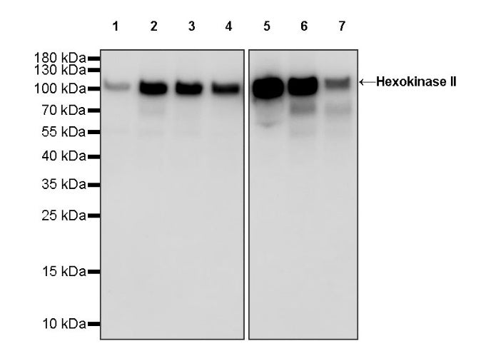 Hexokinase II Rabbit Polyclonal Antibody