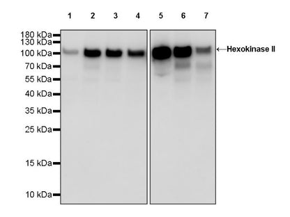 Hexokinase II Rabbit Polyclonal Antibody