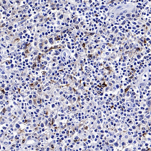 CCL17 Recombinant Rabbit mAb (S-1847-7)