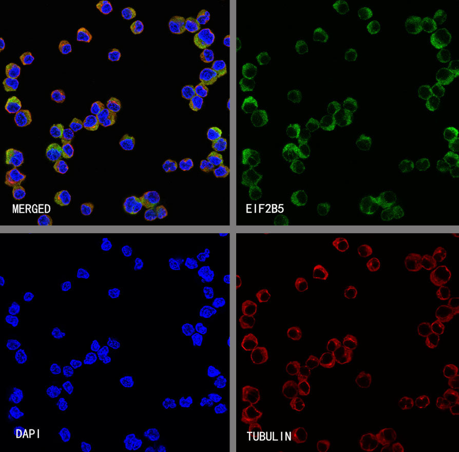 EIF2B5 Recombinant Rabbit mAb (S-3816-3)