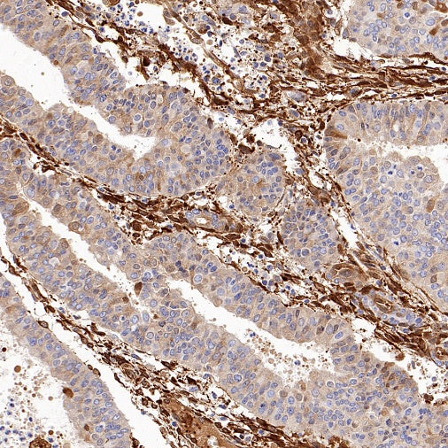 ALDH1A1 Rabbit Polyclonal Antibody