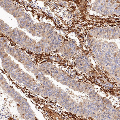 ALDH1A1 Rabbit Polyclonal Antibody