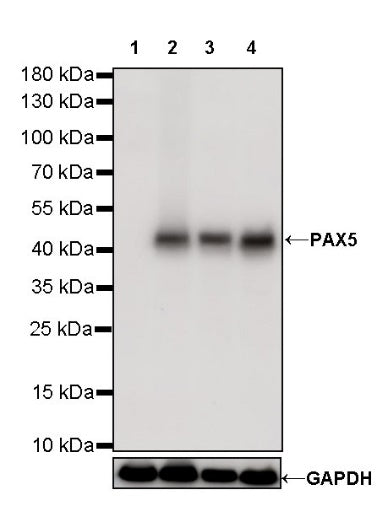 S-RMab® PAX5 Recombinant Rabbit mAb (SDT-R202)