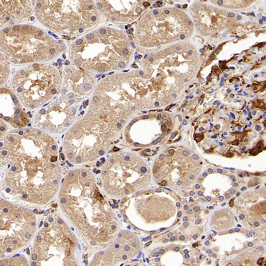 Dctd Recombinant Rabbit mAb (S-4313-16)