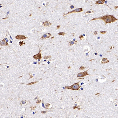 RPS3A Rabbit polyclonal antibody