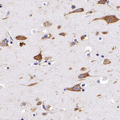 RPS3A Rabbit polyclonal antibody
