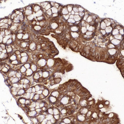Clathrin heavy chain Recombinant Rabbit mAb (S-1690-25)