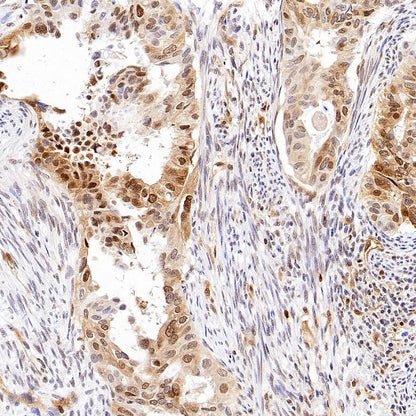 ACLY/ATP citrate lyase Recombinant Rabbit mAb (S-2025-32)