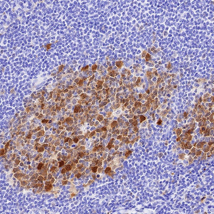 UCHL1 Recombinant Rabbit mAb (S-1765-38)