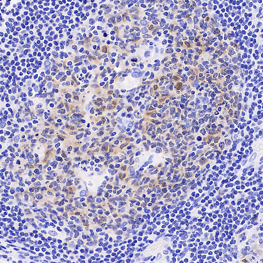 Noxa Recombinant Rabbit mAb (S-5505)