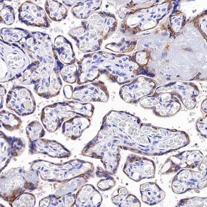 TRIM29 Recombinant Rabbit mAb (S-642-43)