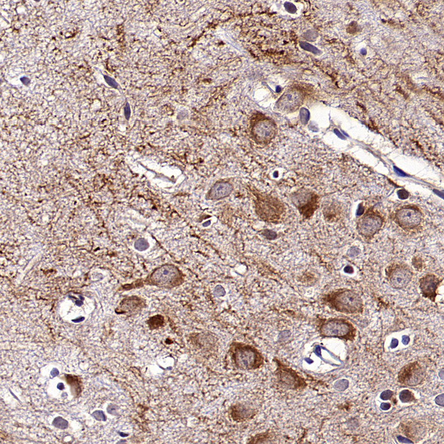 KCNMA1 Recombinant Rabbit mAb (S-2926-33)