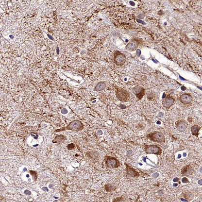 KCNMA1 Recombinant Rabbit mAb (S-2926-33)