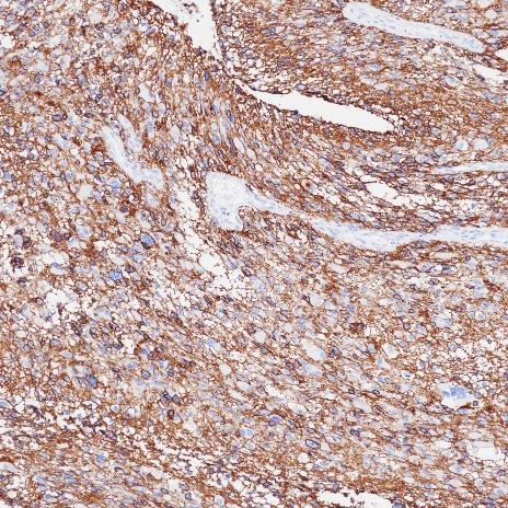 CD56 Recombinant Rabbit Monoclonal Antibody