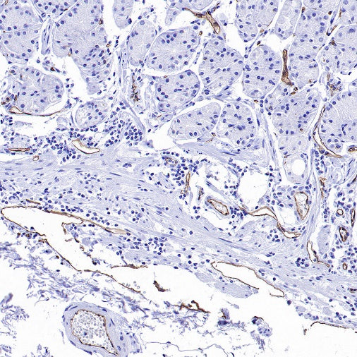 PODXL Recombinant Rabbit mAb (S-2014-9)
