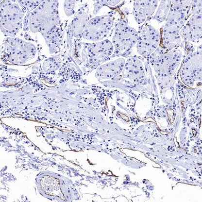 PODXL Recombinant Rabbit mAb (S-2014-9)