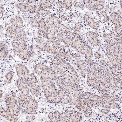 Caspase-2 Recombinant Rabbit mAb (S-3188-3)