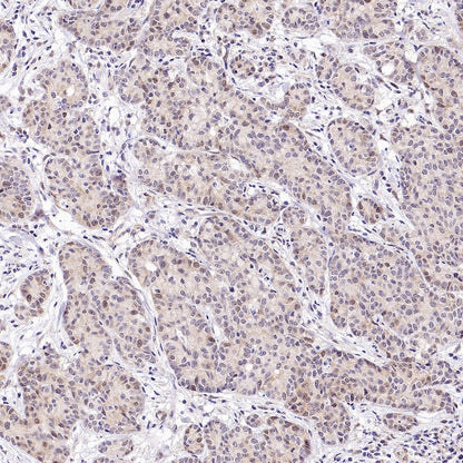 Caspase-2 Recombinant Rabbit mAb (S-3188-3)