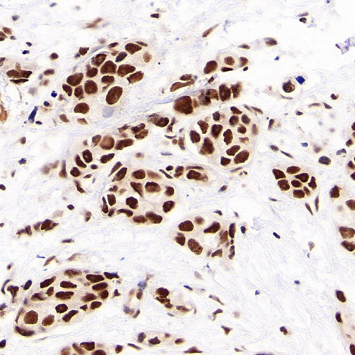 NR1D1 + NR1D2 / RVR Recombinant Rabbit mAb (S-5962)