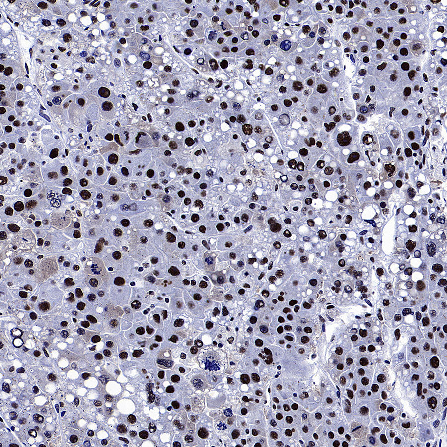 p300 Recombinant Rabbit mAb (S-2612-122)