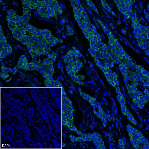 TOM20 Recombinant Rabbit mAb (SDT-2553-11)