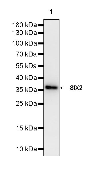 SIX2 Recombinant Rabbit mAb (S-4226-19)